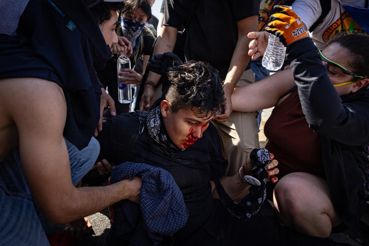People surround a seated injured person 