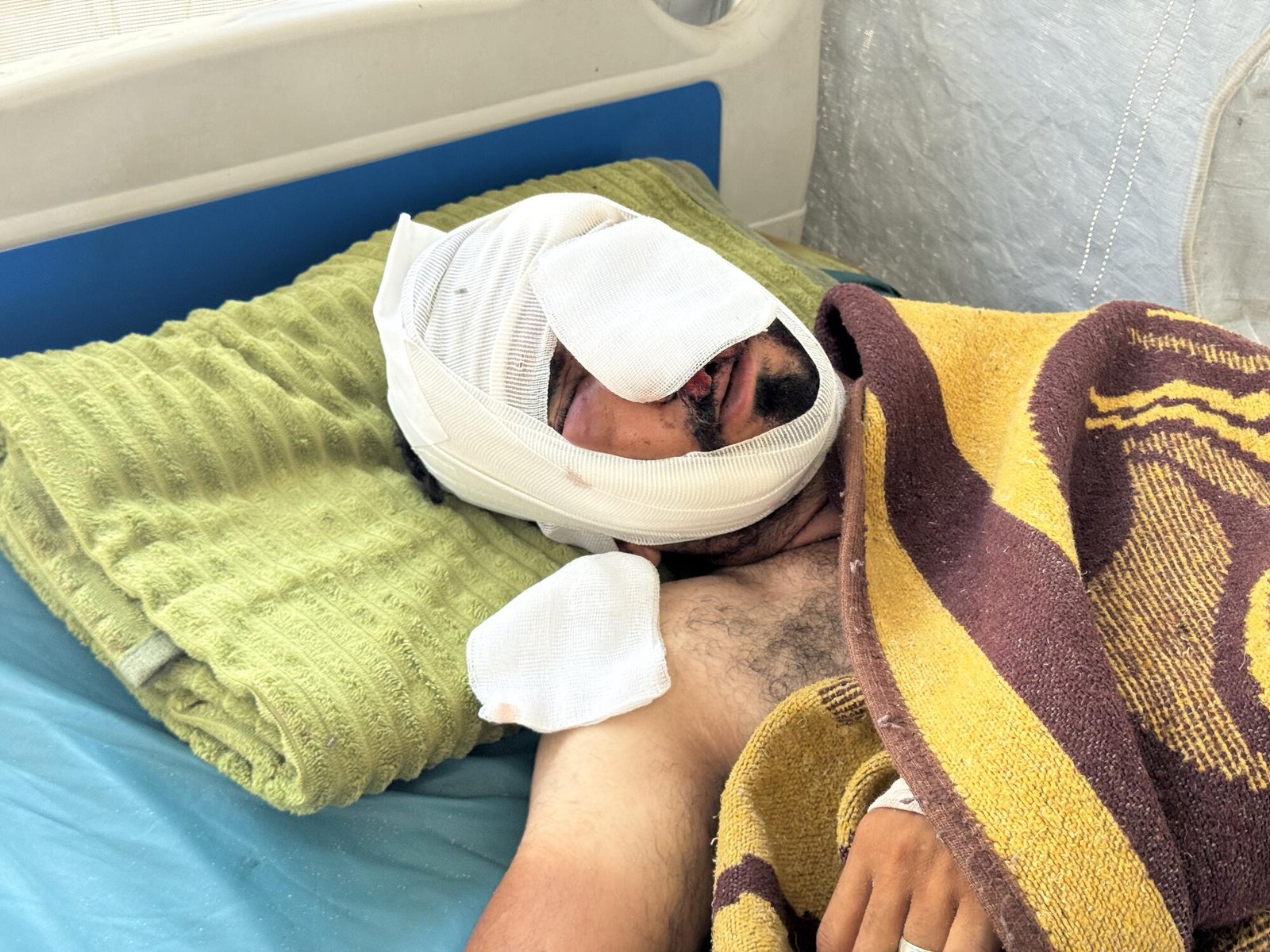 A man with a heavily bandaged head lying on a bed