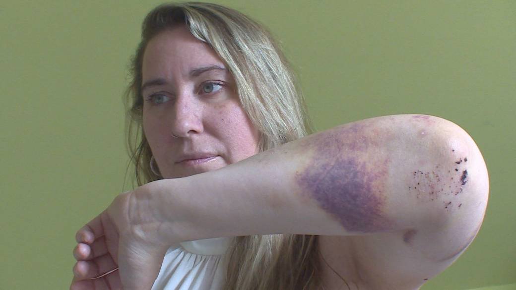 Click to play video: 'Friend of Bailey McCourt hoping violent attack prompts change in B.C.'