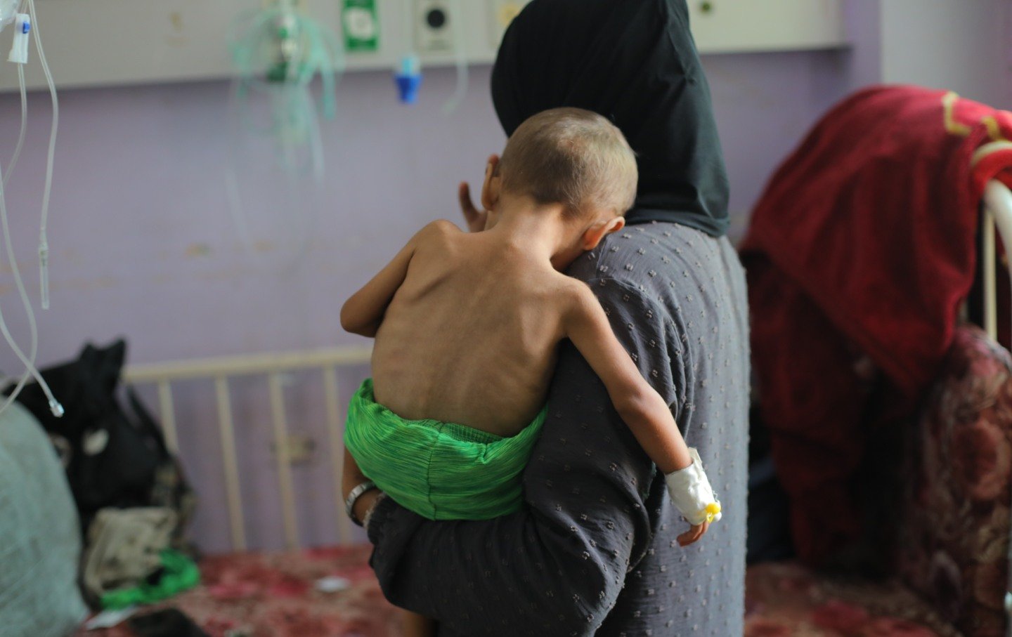 Children of various ages suffering from malnutrition are being treated with limited resources due to shortages of baby formula and medicine at Al-Aqsa Martyrs Hospital in Deir al-Balah, Gaza, on August 11, 2025.
